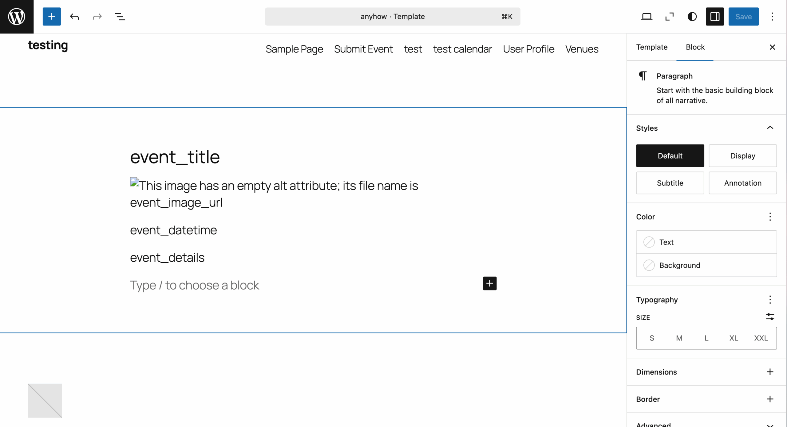 Screenshot: An example custom template created by adding the following meta keys directly into the block editor: event_title, event_image_url, event_datetime, event_details
